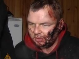 brutal agresion y tortura a un opositor en ucrania brutal agresion y tortura a un opositor en ucrania