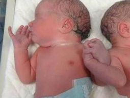 Dos gemelos españoles se dieron la mano al nacer