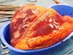 Difunden un video de cómo late el corazón de un adicto fuera de su cuerpo