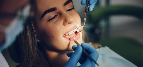 ANMAT prohibió una marca de brackets: cuál no hay que usar