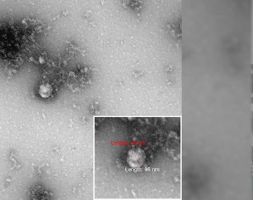 Rusia: sacaron una foto de la variante británica del Covid-19