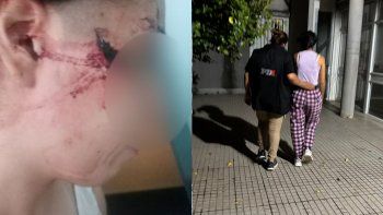 horror en santa fe: atacaron a cuchillazos a una adolescente de 15 anos y le desfiguraron la cara horror en santa fe: atacaron a cuchillazos a una adolescente de 15 anos y le desfiguraron la cara