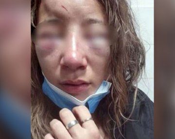 Desfiguraron a una chica a la salida de un boliche y le arrancaron las uñas