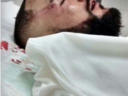 un joven fue brutalmente golpeado por patovicas en un boliche de provincia un joven fue brutalmente golpeado por patovicas en un boliche de provincia