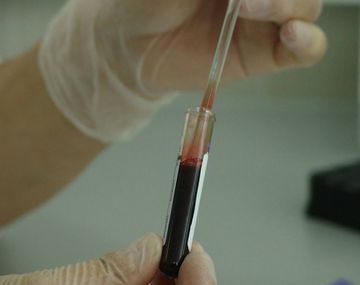 Descubren variante del VIH más virulenta y contagiosa