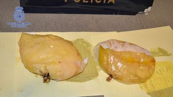 Los implantes mamarios eran bolsas de cocaína