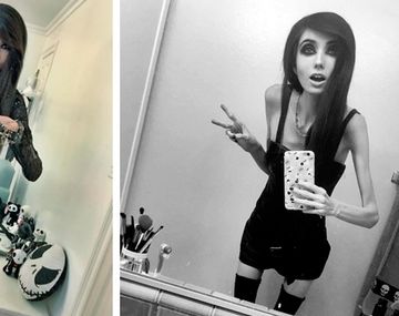 La youtuber Eugenia Cooney, que apenas pesa 27 kilos, es acusada de inducir a la anorexia.