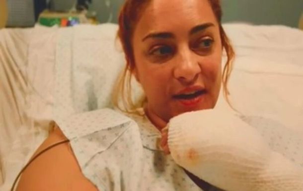La impactante imagen de María Julia Oliván tras sufrir graves quemaduras: así quedó su rostro