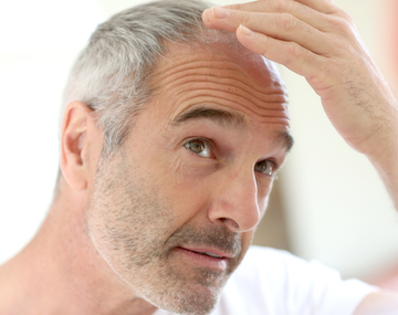 Científicos argentinos consiguieron una solución contra la calvicie