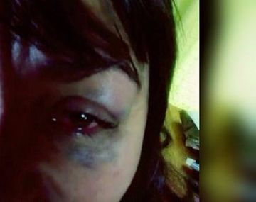 Le pegaron una piña en un bar porque le dijo que no a un hombre