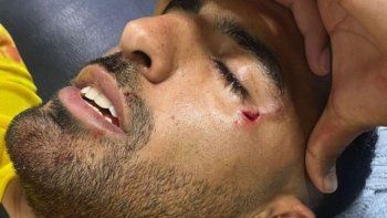 el mensaje del jugador de penarol agredido en la cancha de rosario central el mensaje del jugador de penarol agredido en la cancha de rosario central