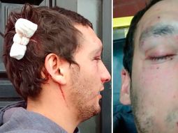 fue a bailar a un boliche de quilmes y un patovica lo desfiguro a trompadas fue a bailar a un boliche de quilmes y un patovica lo desfiguro a trompadas