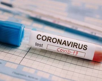 Argentina desarrolla un nuevo kit para detectar el coronavirus