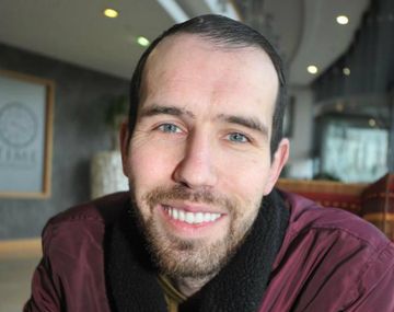 Le tuvieron que sacar 27 dientes podridos para reemplazarlos por unas prótesis