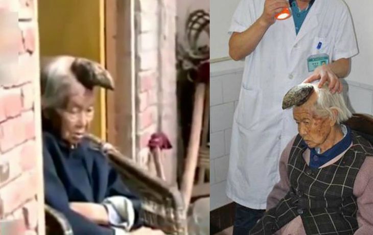 Operarán a una mujer unicornio