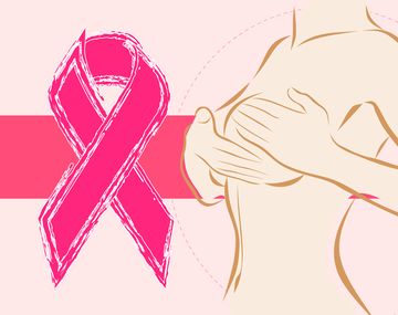 Trivia: ¿cuánto sabés sobre el cáncer de mama?