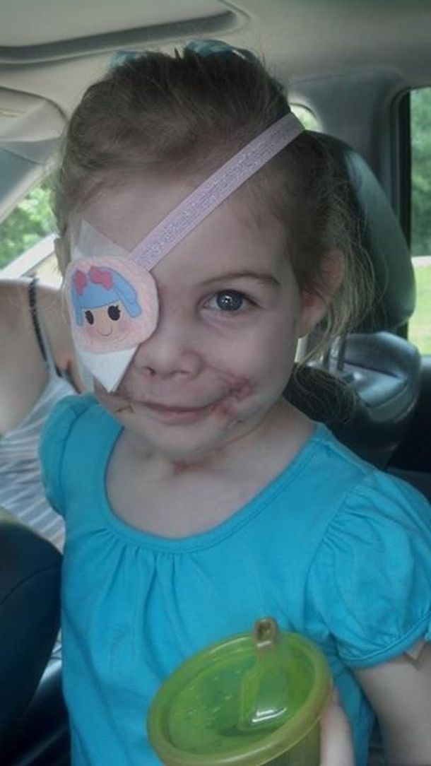 Indemnizan a una nena de 3 años por haberla echado de un restaurante por sus cicatrices