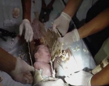 Rescatan a un bebé que fue abandonado en una cloaca