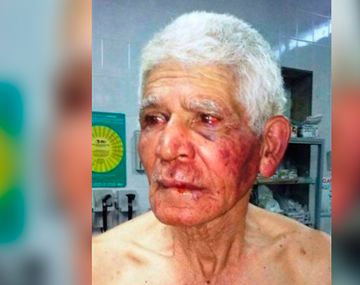 Le orinaron la puerta