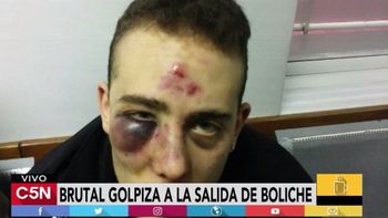 brutal golpiza a la salida de un boliche: le pegaron en el piso y quedo asi brutal golpiza a la salida de un boliche: le pegaron en el piso y quedo asi