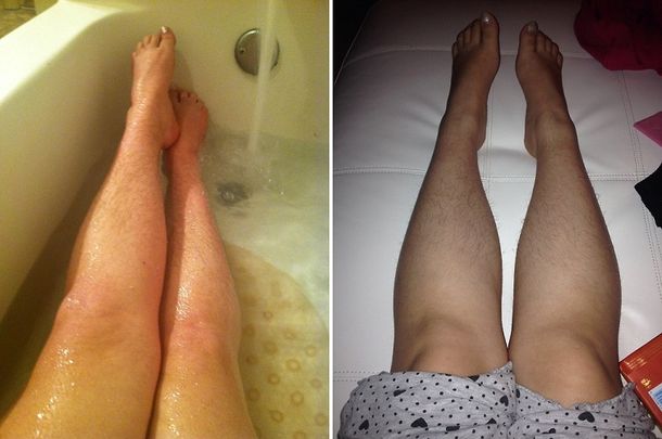 Nueva moda: ellas decidieron no volver a depilarse las piernas y son furor en la web