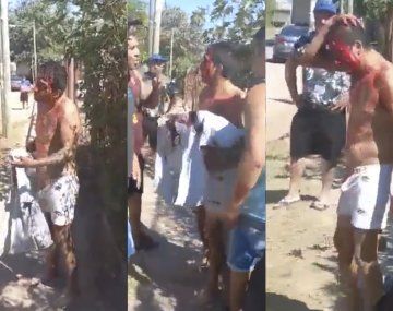 Tiros y golpes entre dos facciones de la barra brava de Chacarita