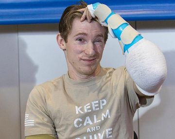 Brendan Marrocco ya puede mover sus brazos