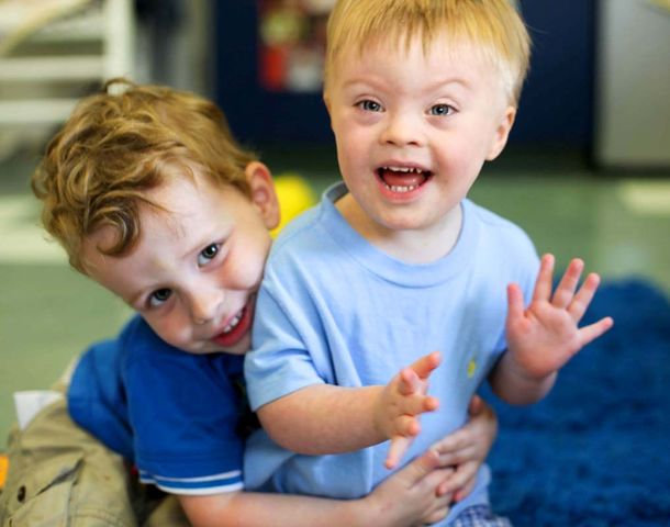 Descubren las raíces moleculares del Síndrome de Down