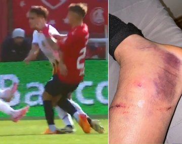 La impactante lesión de un jugador de Independiente: se perdería el clásico