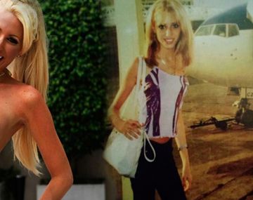 Impactante: la foto de Vicky Xipolitakis cuando sufría anorexia