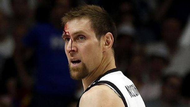 Se la banca siempre: Nocioni sufrió un terrible codazo y siguió jugando