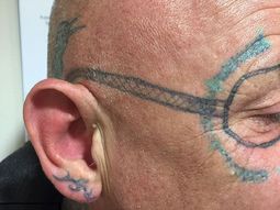 ¿La peor resaca? Se fue de fiesta y despertó con un horrendo tatuaje en la cara