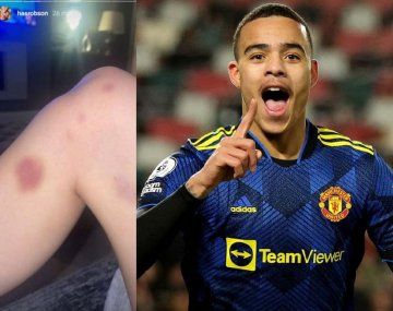 Detuvieron a un jugador del Manchester United tras una fuerte denuncia por violencia de género