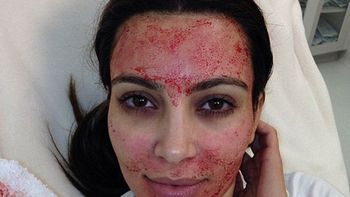 famosa mediatica se somete a un asqueroso tratamiento de belleza famosa mediatica se somete a un asqueroso tratamiento de belleza