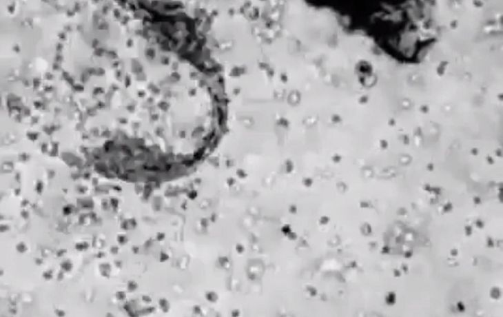 Así atacan los glóbulos blancos a un virus cuando entra a tu organismo