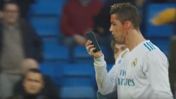 Cristiano Ronaldo se cortó la cara y pidió mirarse con un celular Cristiano Ronaldo se cortó la cara y pidió mirarse con un celular