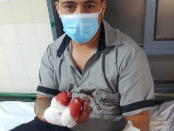 Berazategui: le cortaron el dedo a un colectivero acusado por una infidelidad