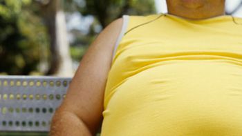 la obesidad afecta a la memoria y causa deterioro cognitivo la obesidad afecta a la memoria y causa deterioro cognitivo