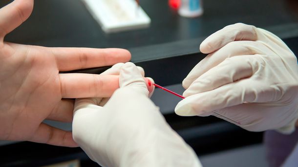 Diagnósticos de VIH en la Argentina