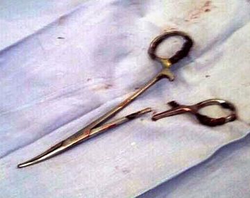 Una tijera en su estómago por 18 años