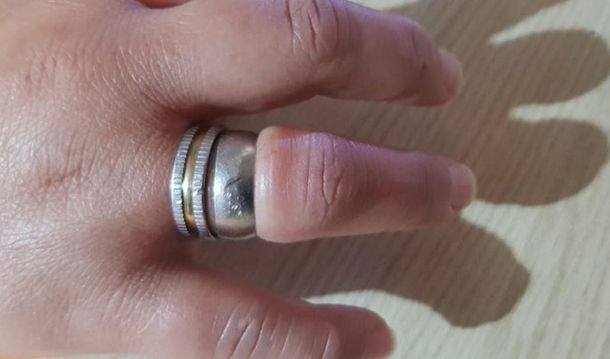 La mujer llam&oacute; a los bomberos para que le ayuden a sacar el anillo.