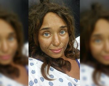 Lisa Theris sobrevivió un mes perdida en el bosque