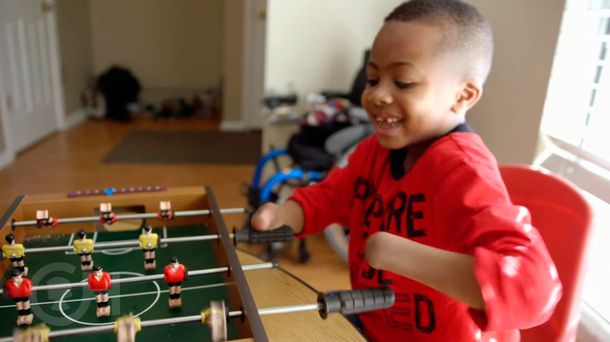 La conmovedora historia del nene que recibió un doble trasplante de mano