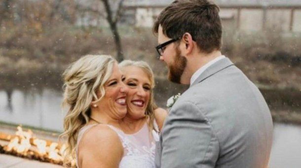Una de las famosas siamesas Hensel encontró el amor y se casó