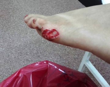 Un matrimonio afirma que fue mordido por pirañas en Misiones