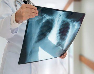 Ómicron afectaría menos a los pulmones que las otras variantes