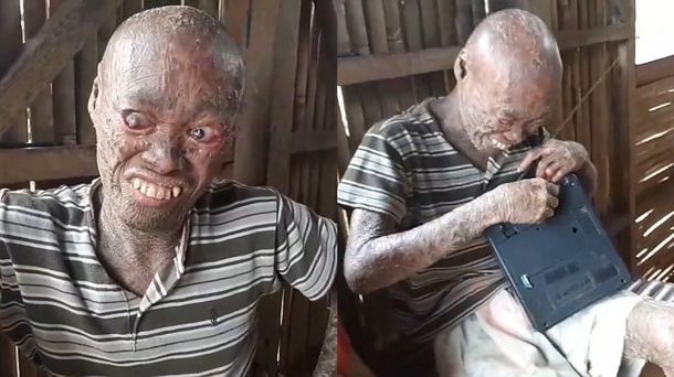 Reloj tiene 26 años y sufre esta condición desde los 12