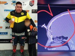 quien es el acusado de clavarle una llave en la cabeza a un jugador del ascenso quien es el acusado de clavarle una llave en la cabeza a un jugador del ascenso