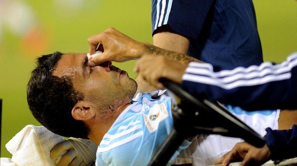 Carlos Tevez sufrió una fisura de tabique nasal pero podría jugar con Boca