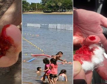 Fueron a un balneario y los atacaron las palometas en Chaco. Fotos: Chaco dia por dia.&nbsp;